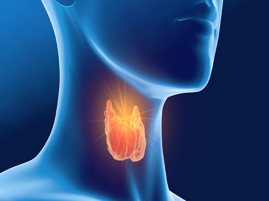 درمان کم کاری تیروئید با گردو